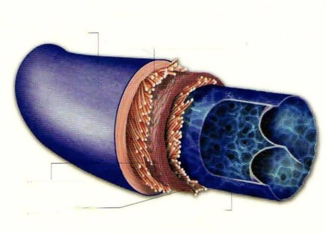 The causes of varicose veins
