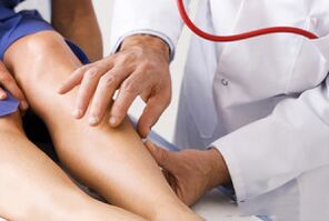 Varicose veins on the legs