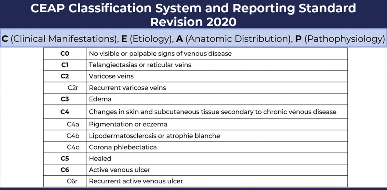 Stages of varicose veins according to the CEAP classification modified in 2020
