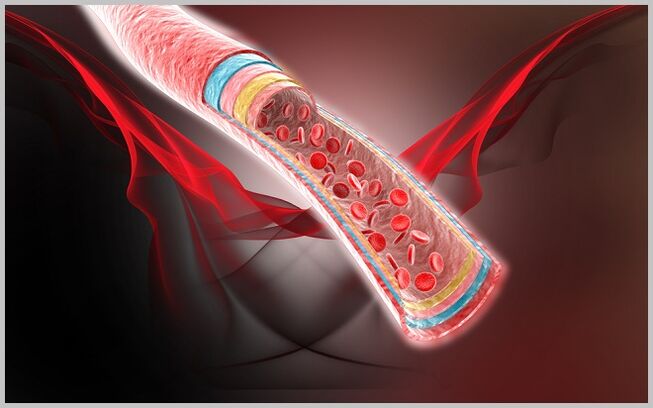 blood flow in the veins after treatment of varicose veins with gel